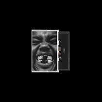 BULLY(CASSETTE TAPE)